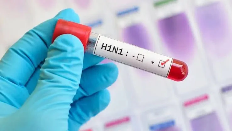 Mengenal 7 Gejala Influenza A dan Deretan Kelompok Rentannya